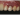 deciduous canines